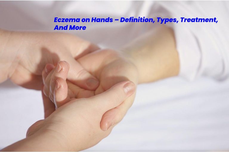 Eczema on Hands