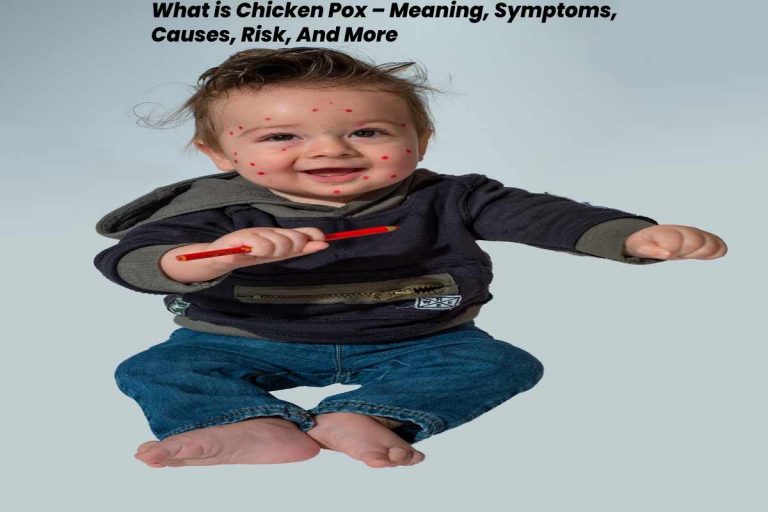 chicken pox