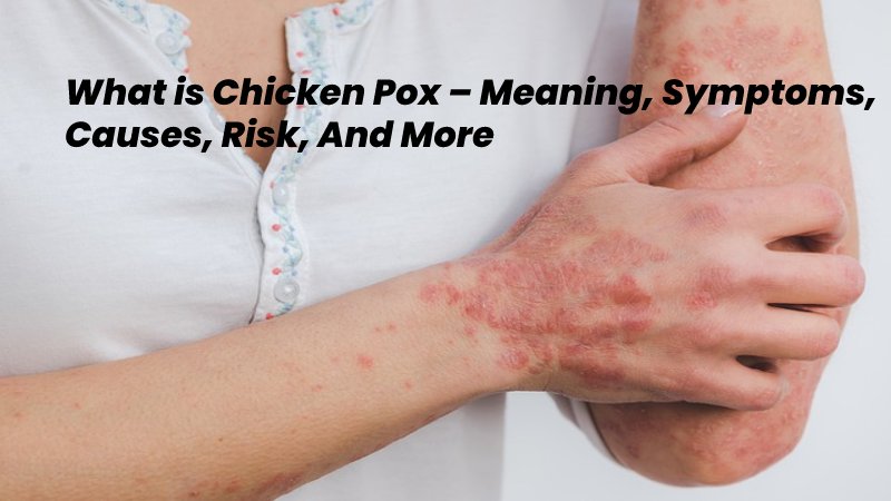 chickenpox