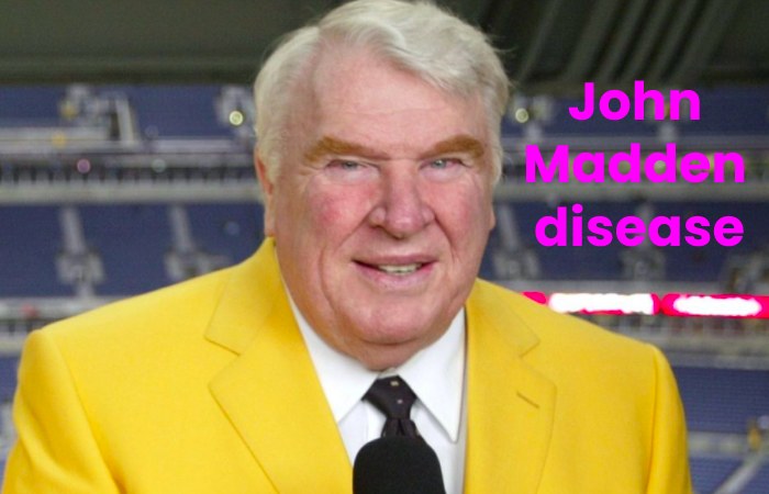 John Madden disease 
