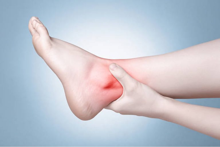 Ankle Fracture