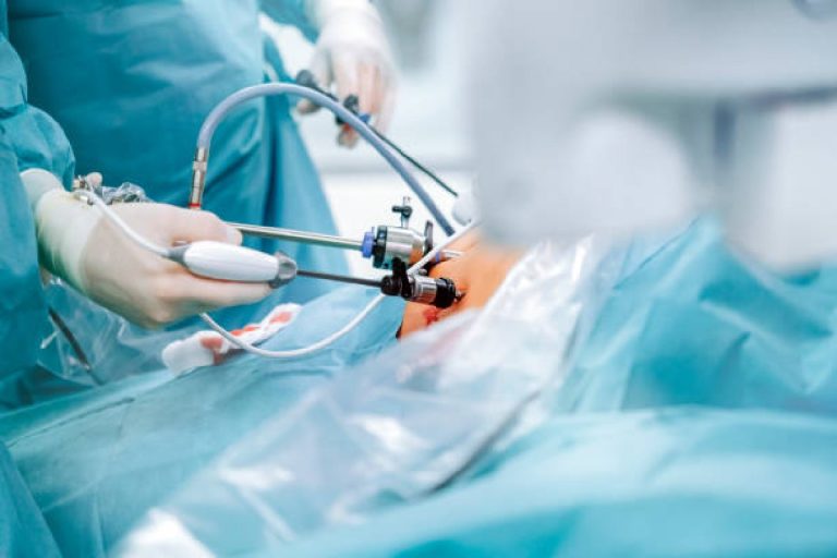 Gastric Bypass