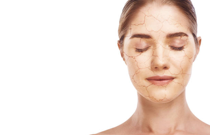 Dehydrated Skin Test Face