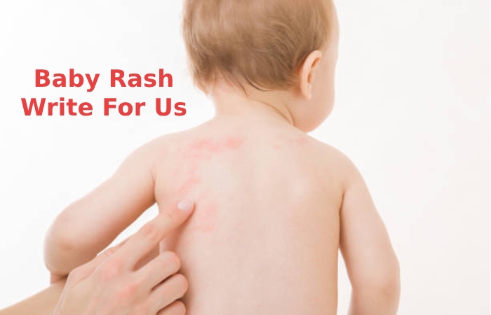 Baby Rash Write For Us