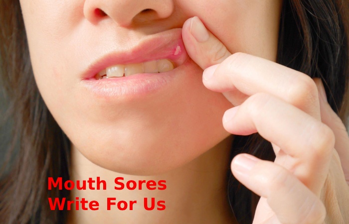 Mouth Sores Write For Us