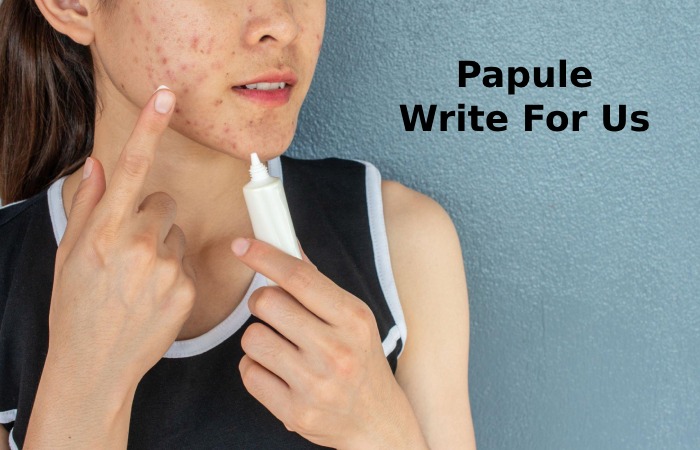 Papule Write For Us