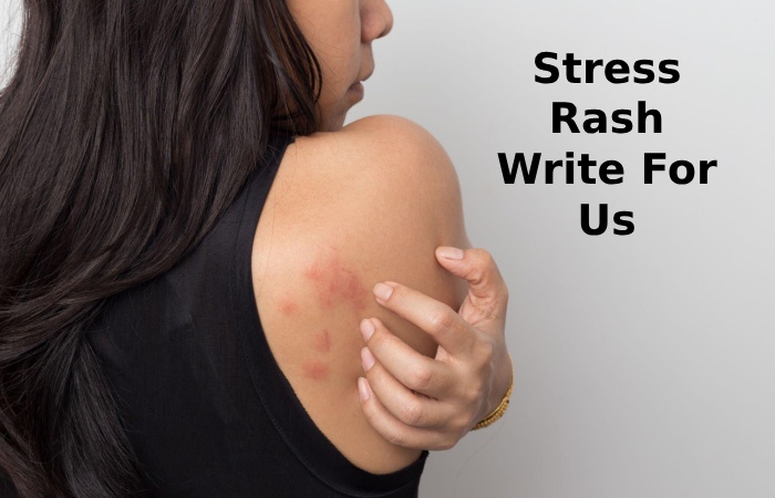 Stress Rash Write For Us