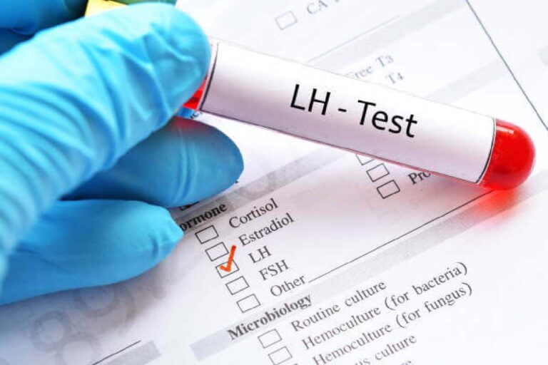 LH Test
