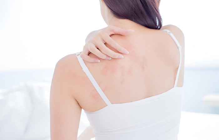 Stress Rash Write For Us
