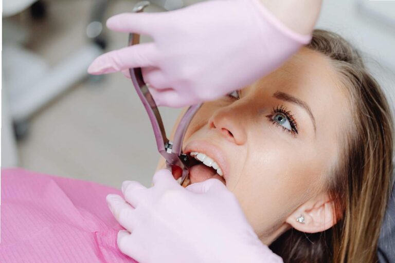 Root Canal vs Tooth Extraction_ Which Option is Better_